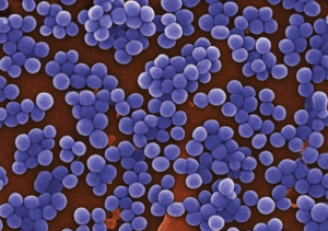Figure 1: MRSA under microscope, morphology and Microscopic appearance of MRSA, colony  morphology of colonies on agar, clinical significance.