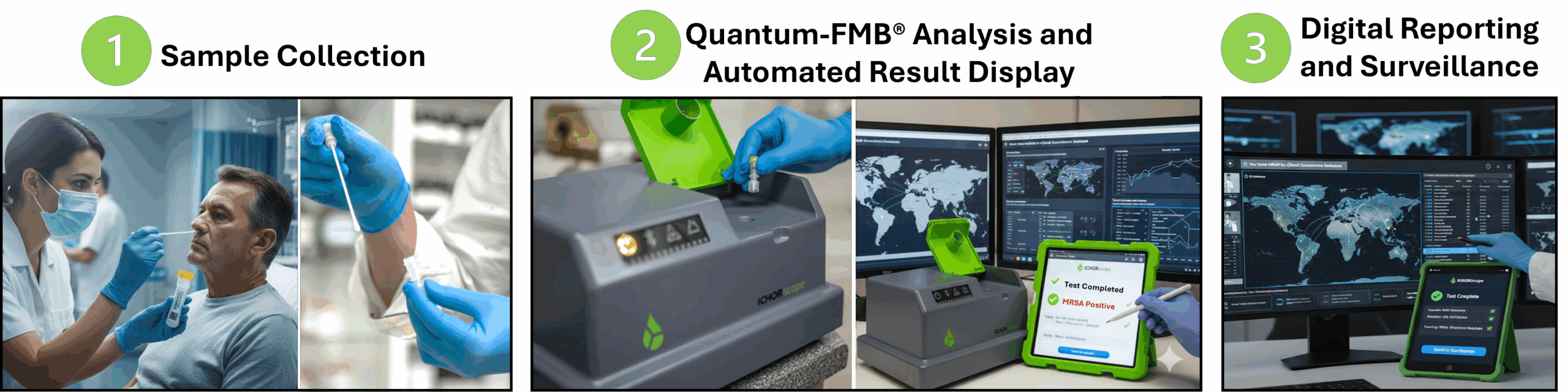 Figure 3: Customer Journey with ICHORtec’s Q-FMB® TB POC Platform. Sample in. Quantum analysis. Automated result. Instant reporting. Same day decision.